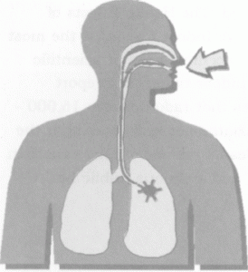 radon-lung-cancer